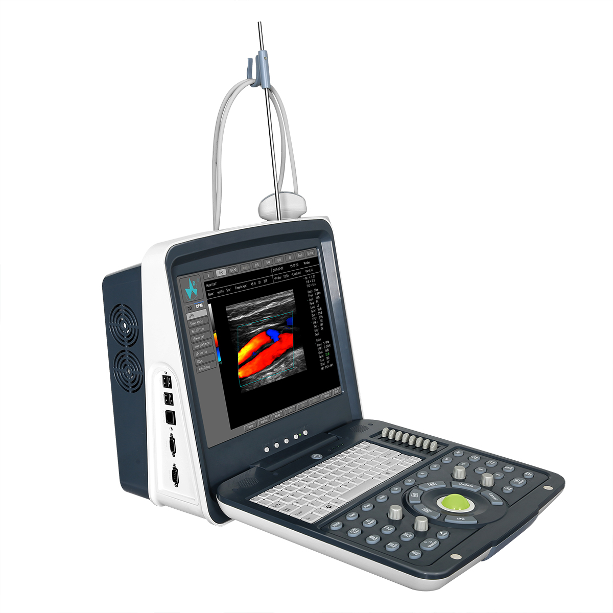 FDC6100 Full Digital Color Doppler Diagnostic System